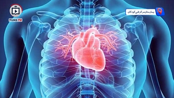 کارنامه موفق عمل جراحی کم‌تهاجمی قلب کودکان در بیمارستان مرکز طبی کودکان